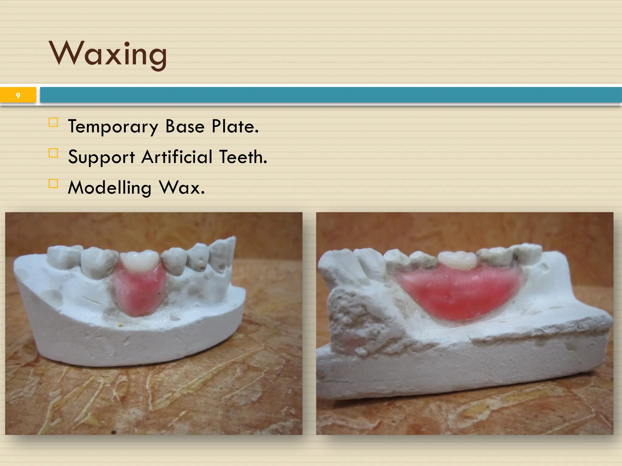 Waxing
 Temporary Base Plate.
 Support Artificial Teeth.
 Modelling Wax.
9
 