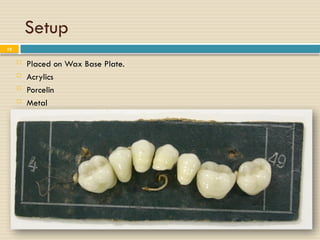 Resin Rest Rpd stages of RPD 4) Переносят направление последней на боковую поверхность ...