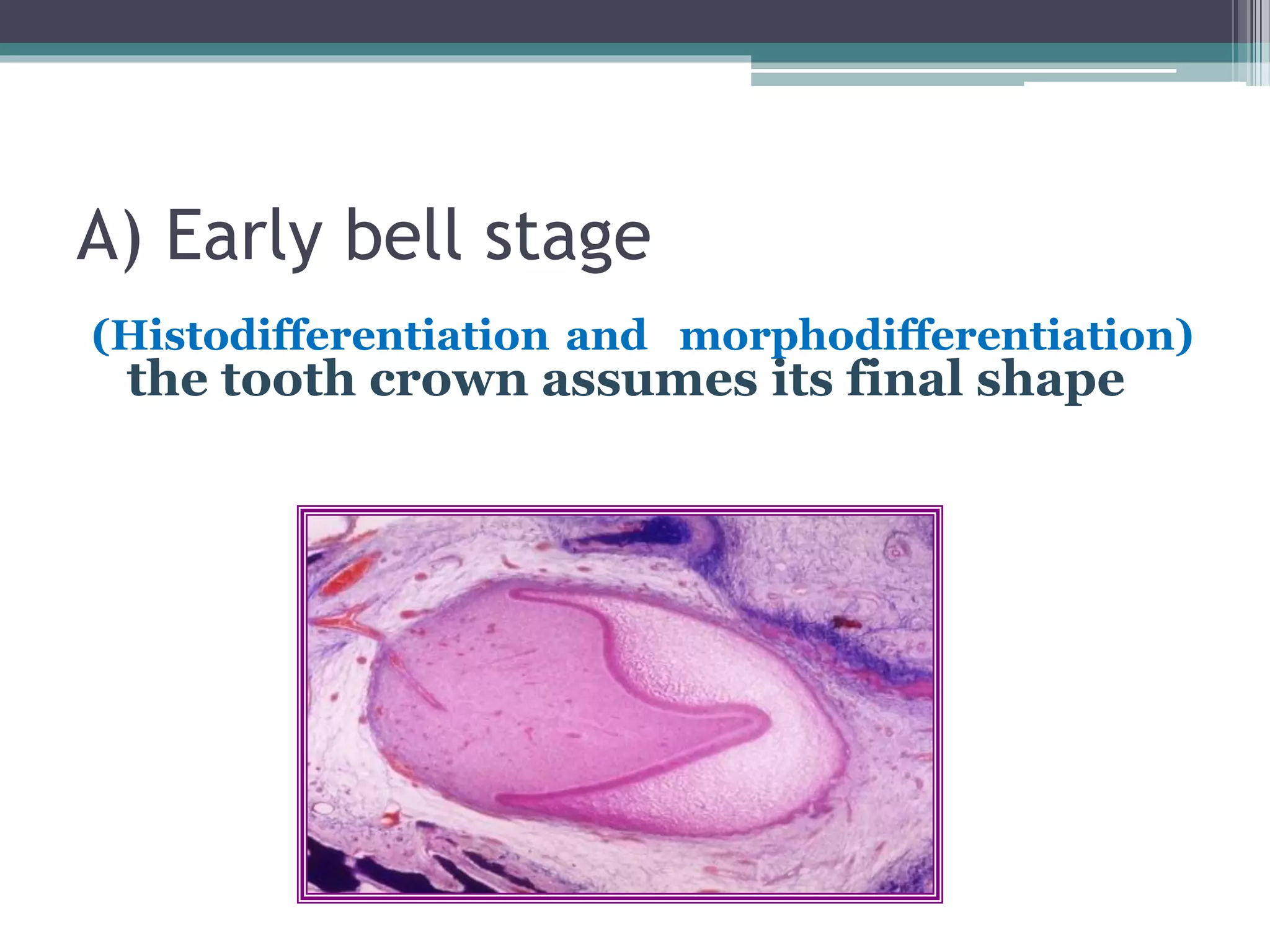 A) Early bell stage
(Histodifferentiation and morphodifferentiation)
the tooth crown assumes its final shape
 