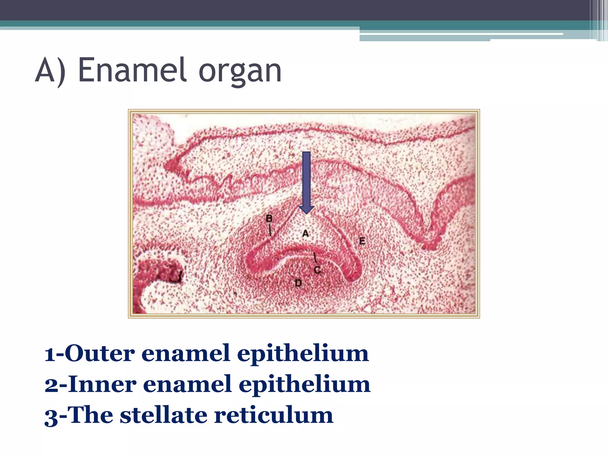 A) Enamel organ
1-Outer enamel epithelium
2-Inner enamel epithelium
3-The stellate reticulum
 