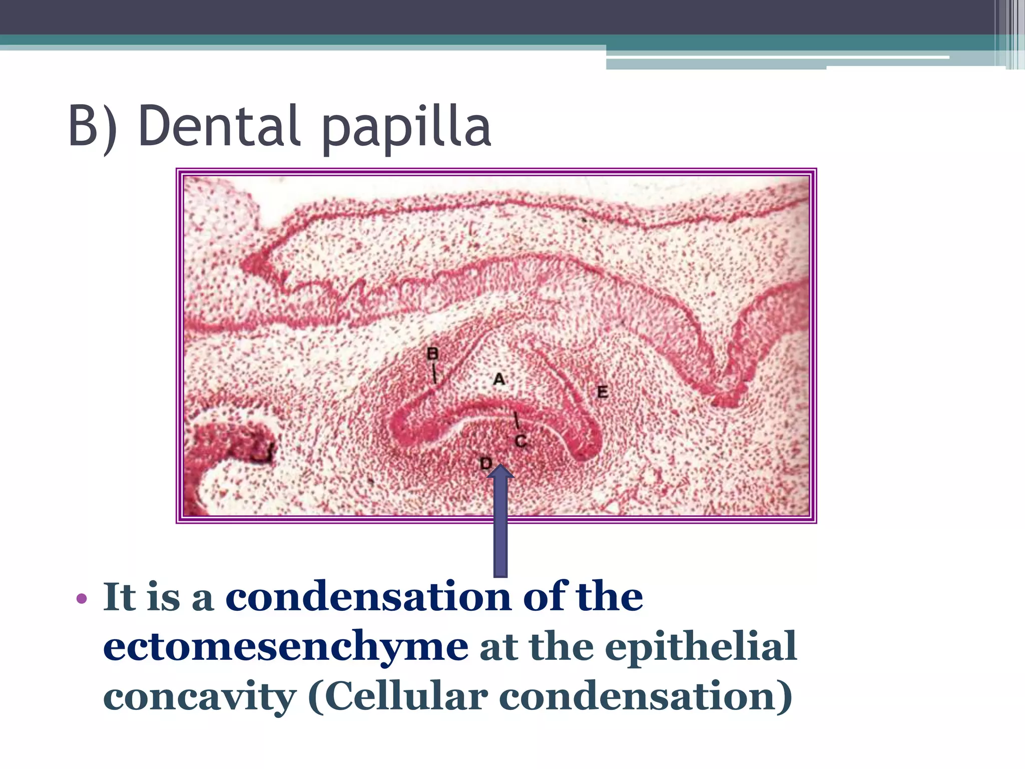 B) Dental papilla
• It is a condensation of the
ectomesenchyme at the epithelial
concavity (Cellular condensation)
 