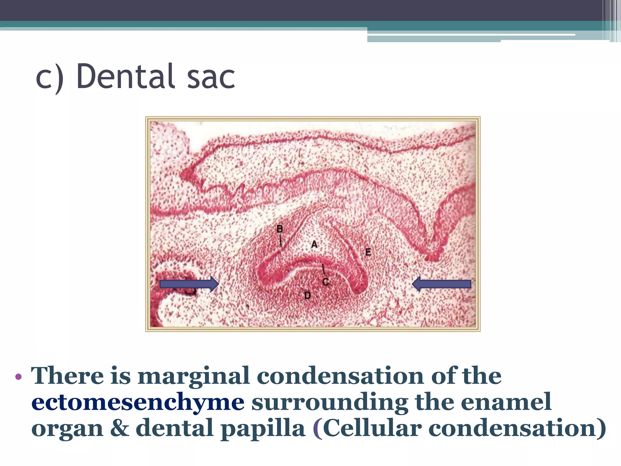 c) Dental sac
• There is marginal condensation of the
ectomesenchyme surrounding the enamel
organ & dental papilla (Cellular condensation)
 