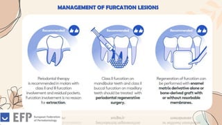 MANAGEMENT OF FURCATION LESIONS
 