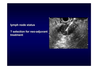 lymph node status

? selection for neo-adjuvant
treatment
 