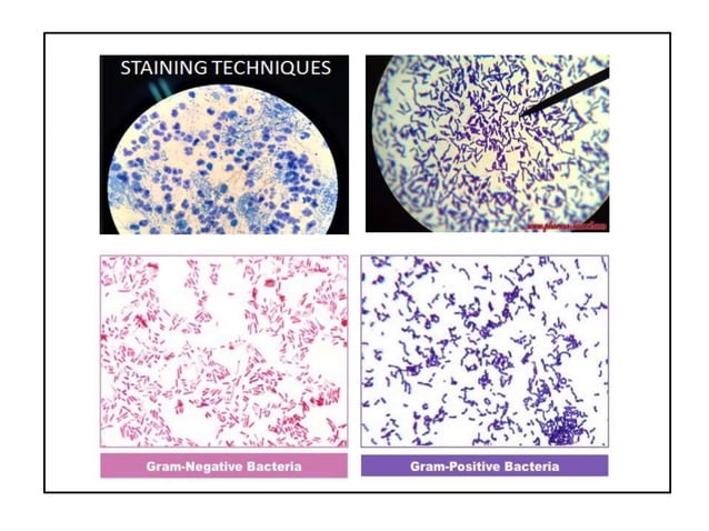 Megative Staining Staining | PPT