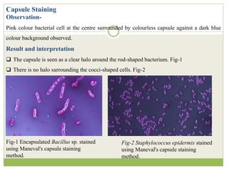Observation-
Pink colour bacterial cell at the centre surrounded by colourless capsule against a dark blue
colour background observed.
Result and interpretation
 The capsule is seen as a clear halo around the rod-shaped bacterium. Fig-1
 There is no halo surrounding the cocci-shaped cells. Fig-2
Capsule Staining
Fig-1 Encapsulated Bacillus sp. stained
using Maneval's capsule staining
method.
Fig-2 Staphylococcus epidermis stained
using Maneval's capsule staining
method.
 