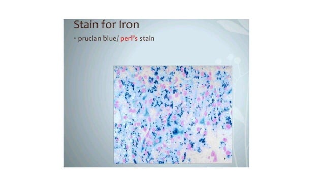Stains and staining procedures in Pathology pptx | PPT