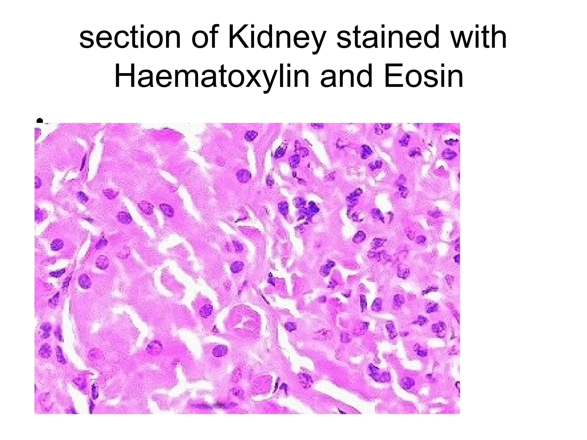 section of Kidney stained with
Haematoxylin and Eosin
•
 