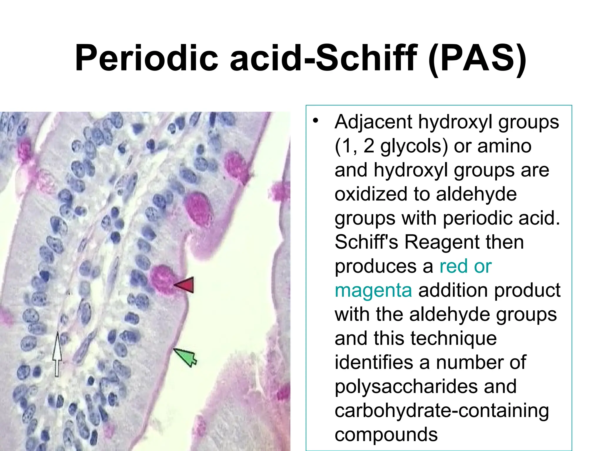 Periodic acid-Schiff (PAS)
• Adjacent hydroxyl groups
(1, 2 glycols) or amino
and hydroxyl groups are
oxidized to aldehyde
groups with periodic acid.
Schiff's Reagent then
produces a red or
magenta addition product
with the aldehyde groups
and this technique
identifies a number of
polysaccharides and
carbohydrate-containing
compounds
 