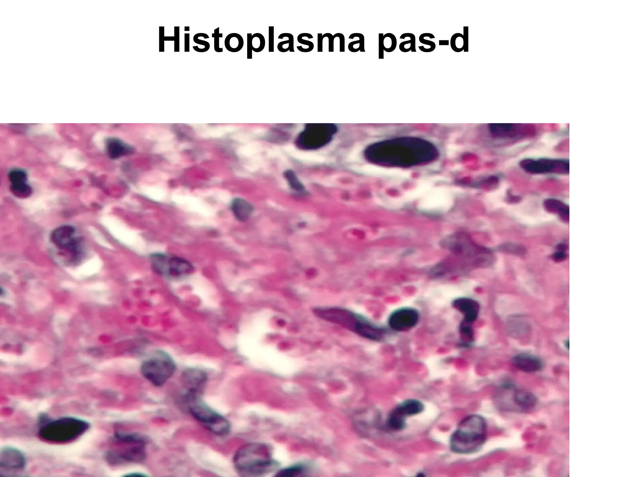 Histoplasma pas-d
 