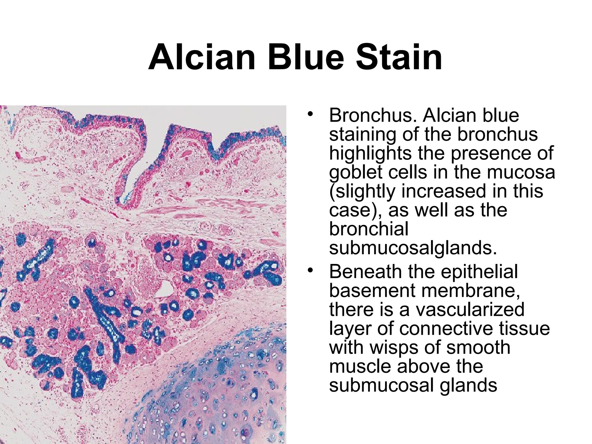 Alcian Blue Stain
• Bronchus. Alcian blue
staining of the bronchus
highlights the presence of
goblet cells in the mucosa
(slightly increased in this
case), as well as the
bronchial
submucosalglands.
• Beneath the epithelial
basement membrane,
there is a vascularized
layer of connective tissue
with wisps of smooth
muscle above the
submucosal glands
 