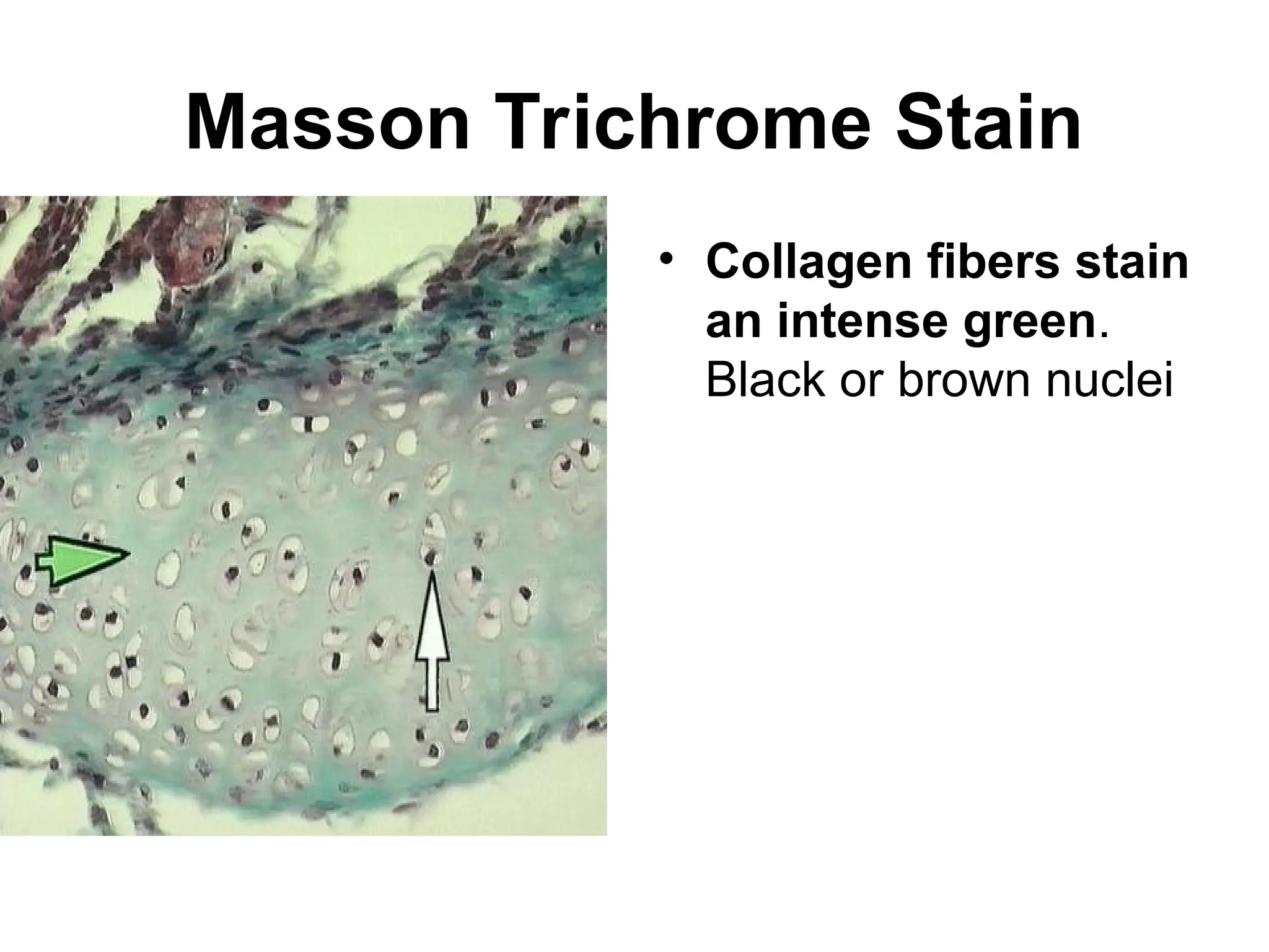Masson Trichrome Stain
• Collagen fibers stain
an intense green.
Black or brown nuclei
 