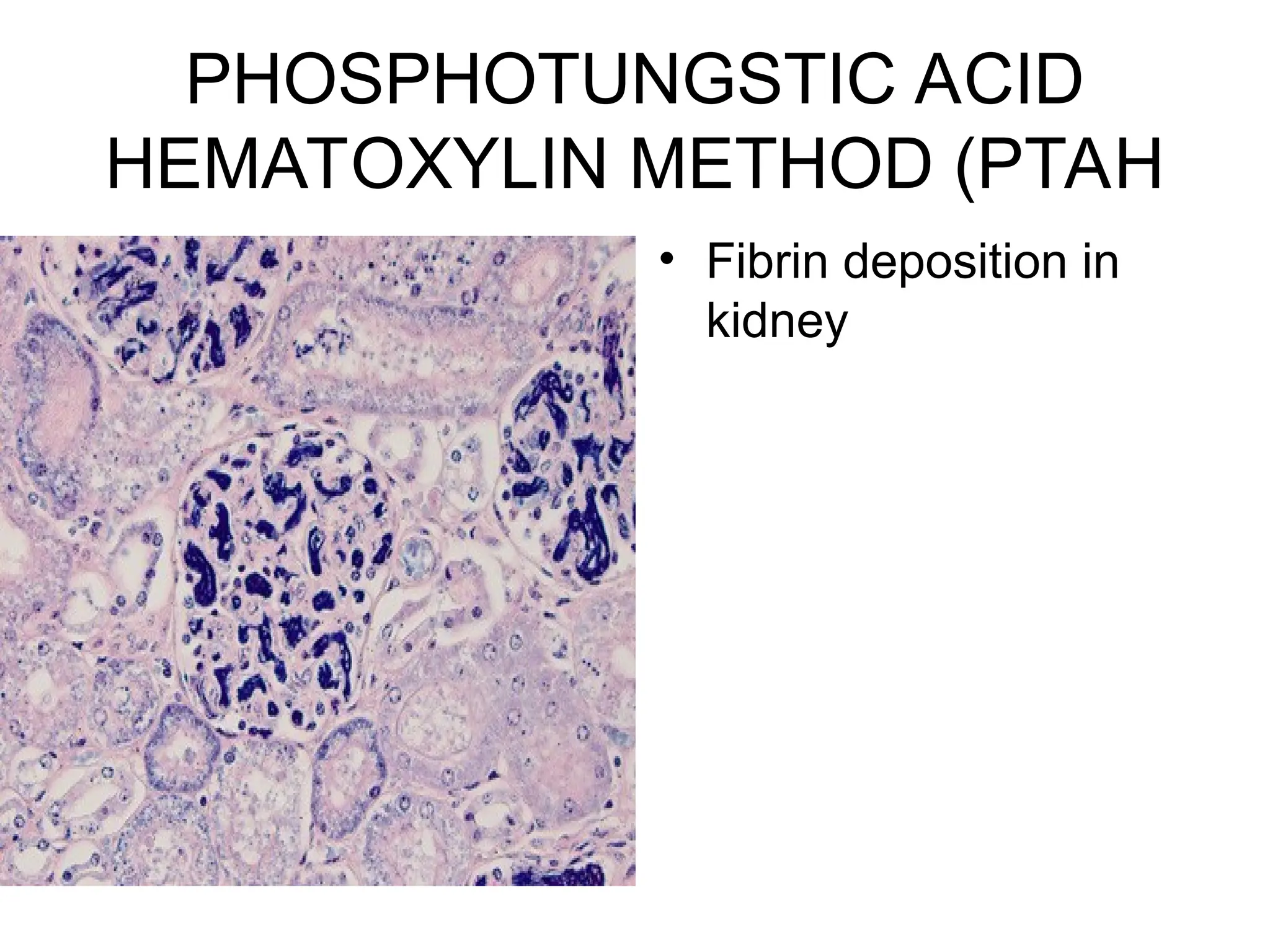PHOSPHOTUNGSTIC ACID
HEMATOXYLIN METHOD (PTAH
• Fibrin deposition in
kidney
 