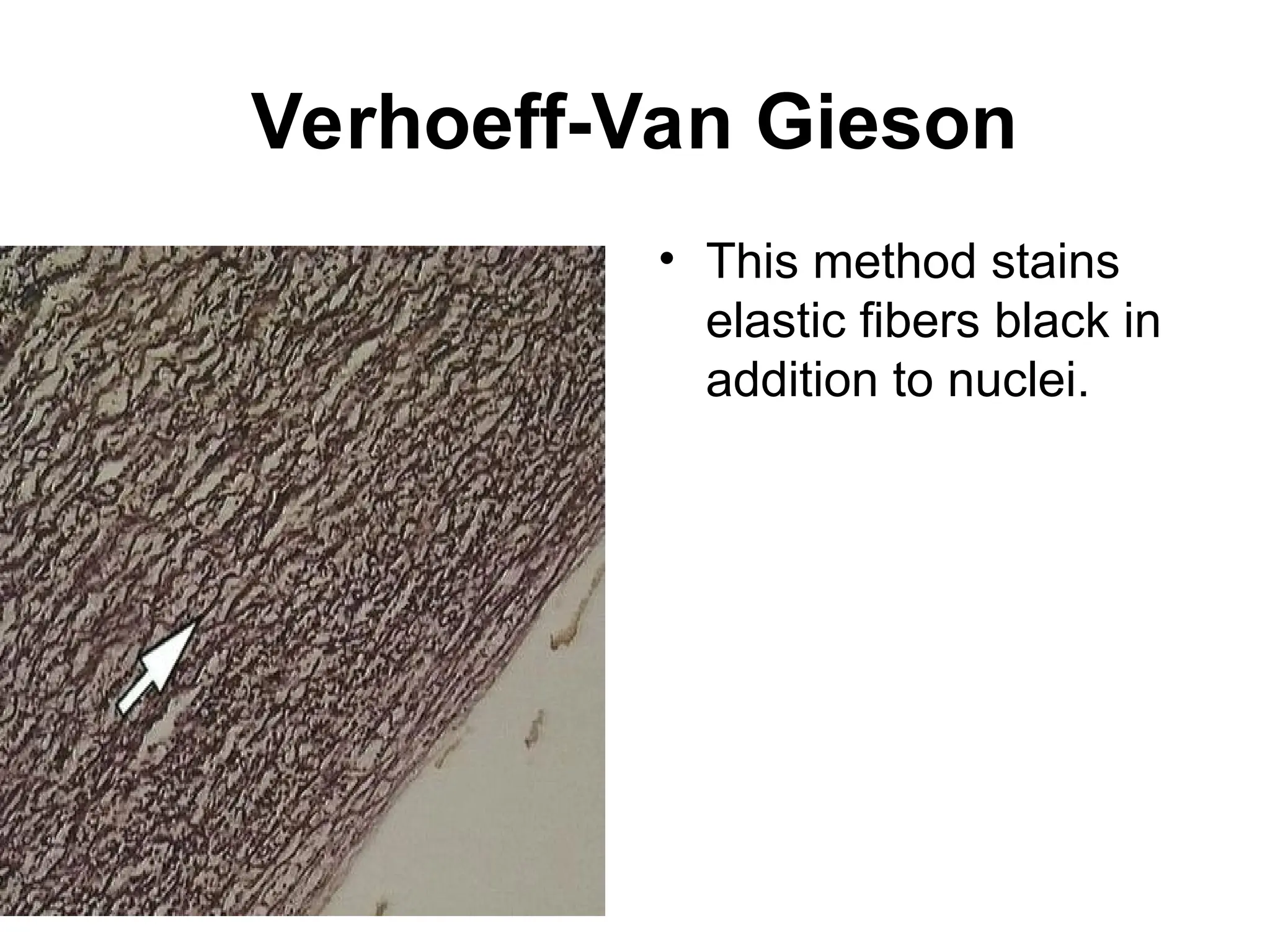 Verhoeff-Van Gieson
• This method stains
elastic fibers black in
addition to nuclei.
 