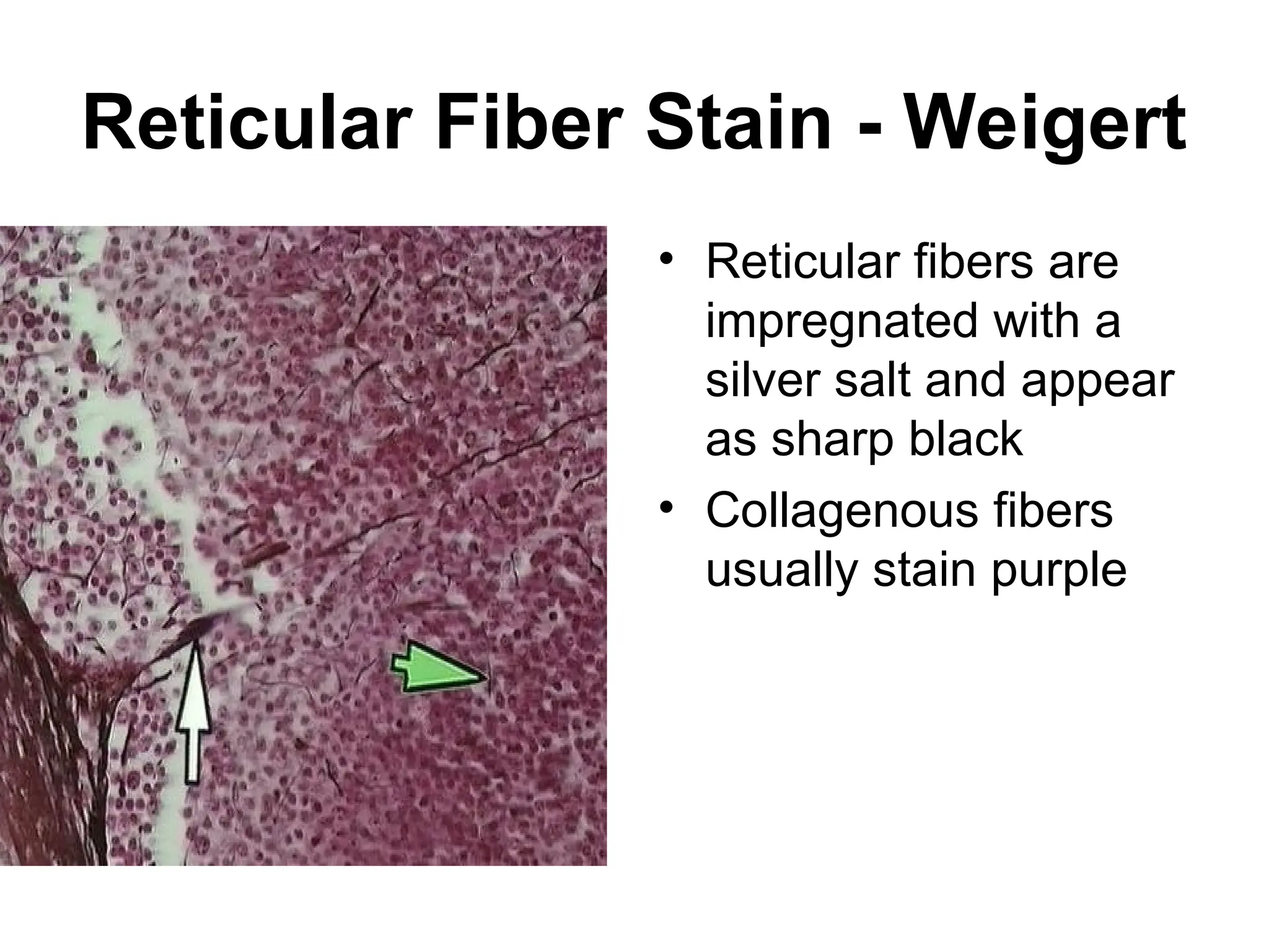 Reticular Fiber Stain - Weigert
• Reticular fibers are
impregnated with a
silver salt and appear
as sharp black
• Collagenous fibers
usually stain purple
 