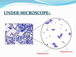 UNDER MICROSCOPE:-
Staphylococci
Streptococcus
 
