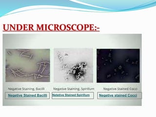 UNDER MICROSCOPE:-
Negetive Stained Bacilli Netetive Stained Spirillum Negetive stained Cocci
 