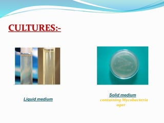 CULTURES:-
Liquid medium
Solid medium
containing Mycobacteria
agar
 