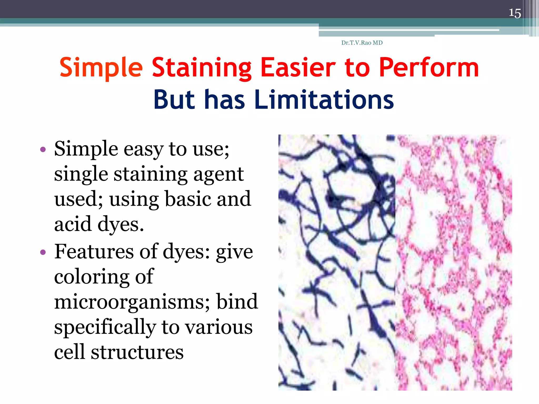 Simple Staining Easier to Perform
But has Limitations
• Simple easy to use;
single staining agent
used; using basic and
acid dyes.
• Features of dyes: give
coloring of
microorganisms; bind
specifically to various
cell structures
15
Dr.T.V.Rao MD
 
