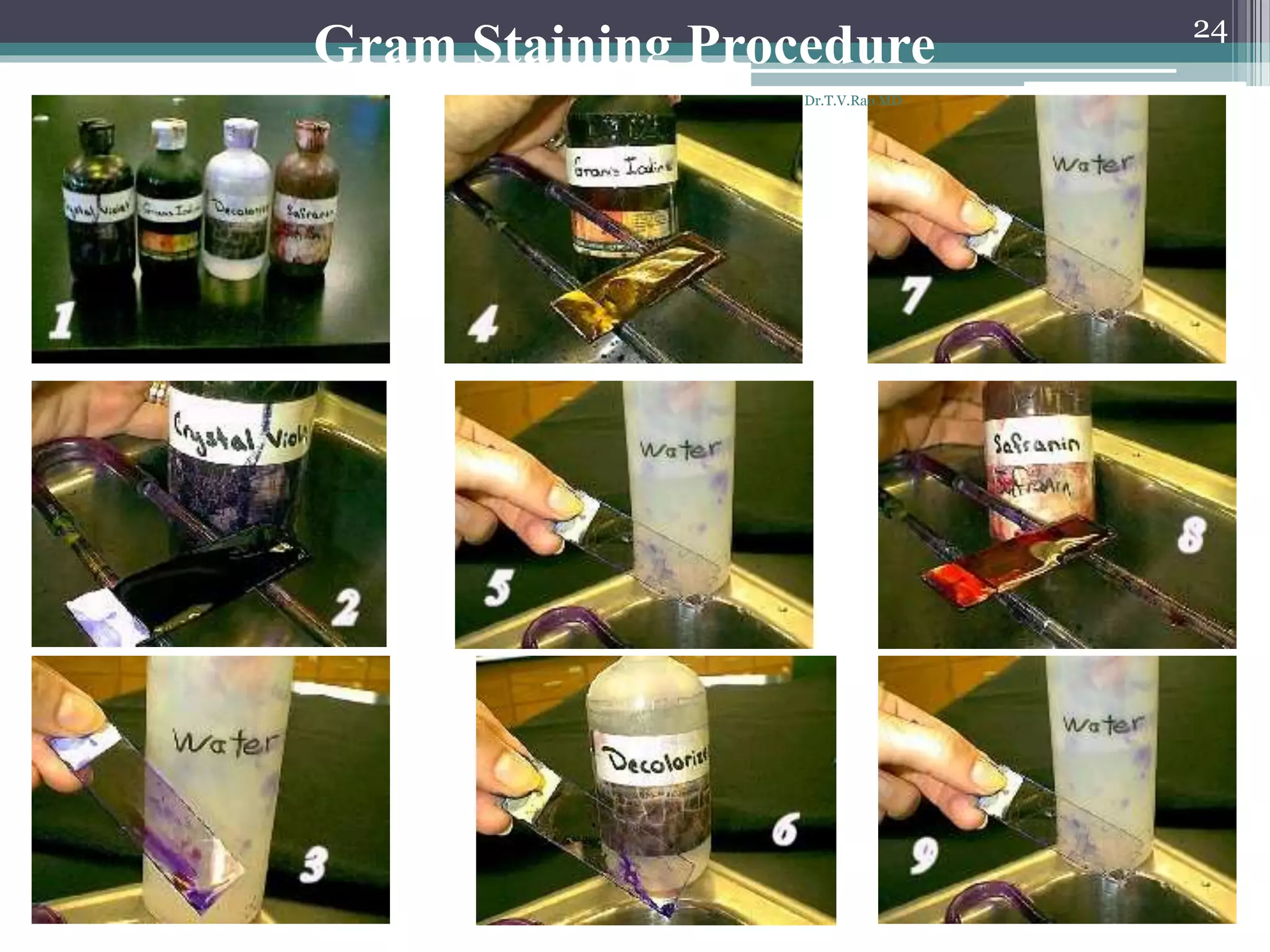 Gram Staining Procedure 24
Dr.T.V.Rao MD
 