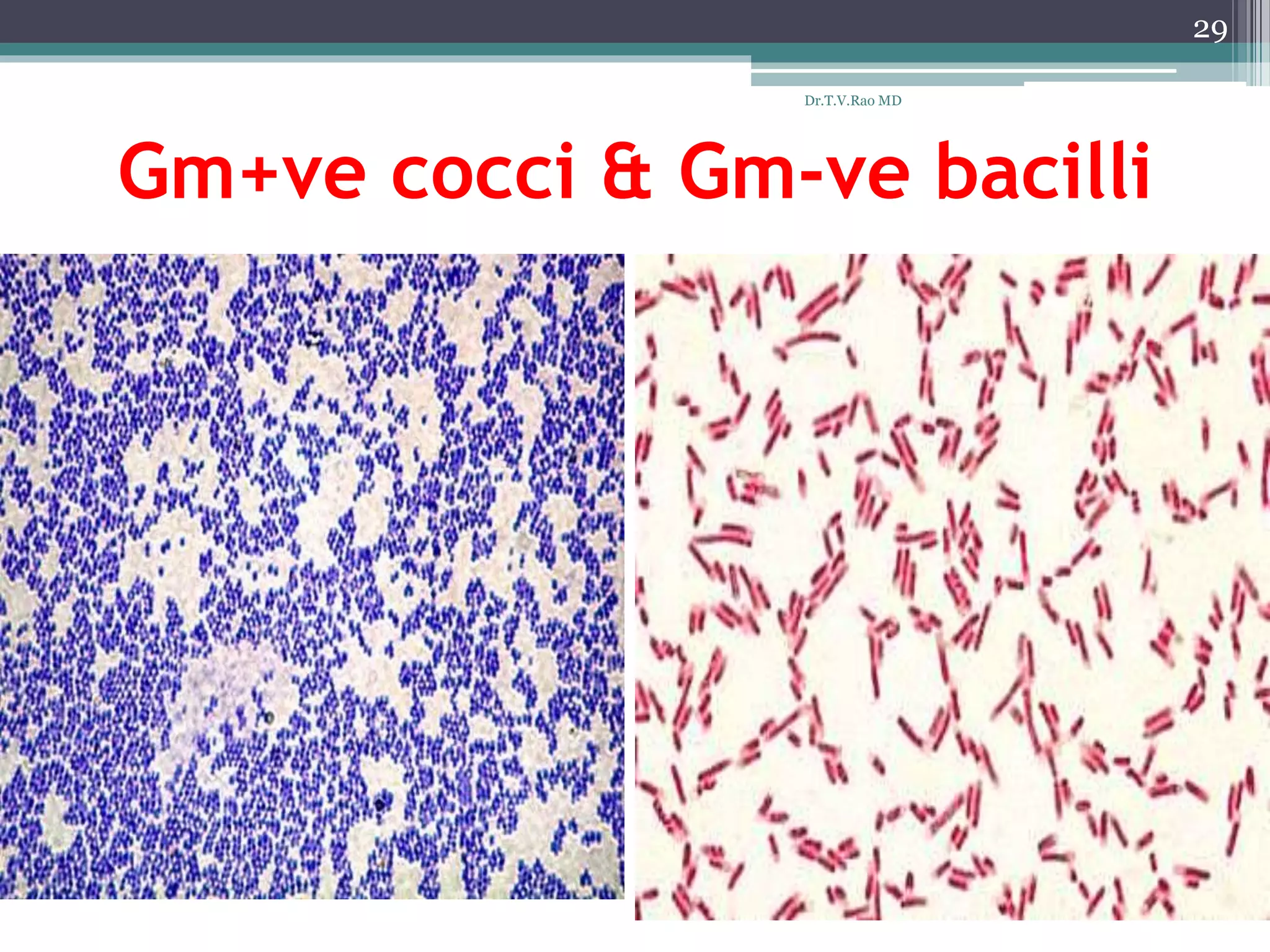 Gm+ve cocci & Gm-ve bacilli
29
Dr.T.V.Rao MD
 
