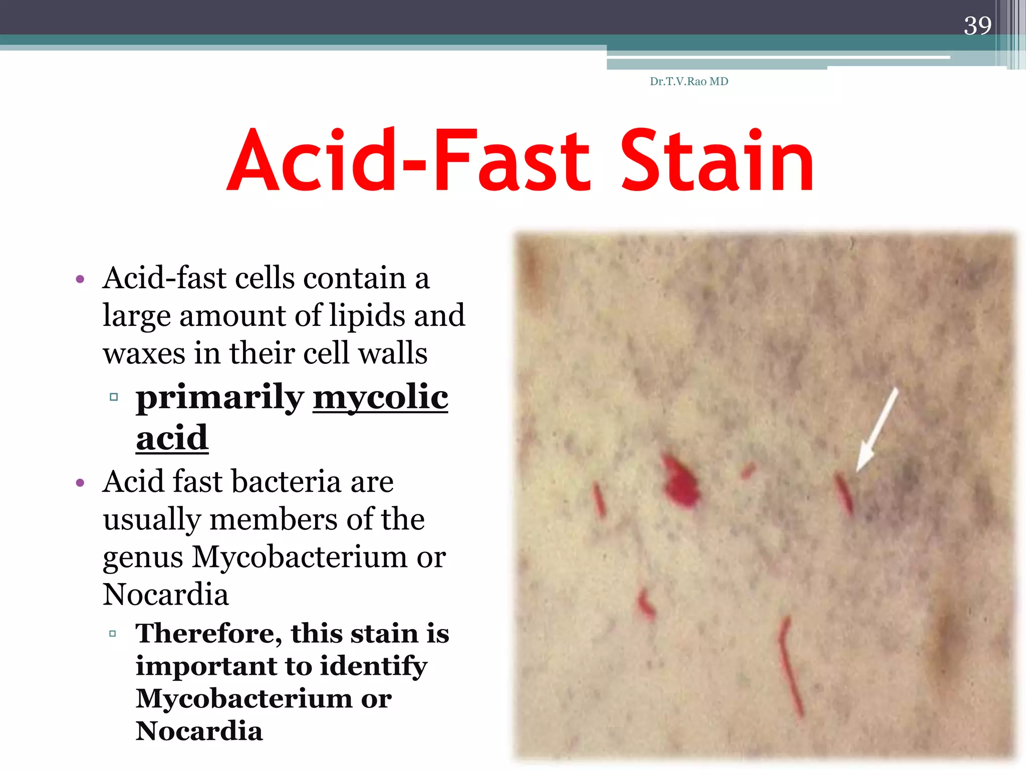 Acid-Fast Stain
• Acid-fast cells contain a
large amount of lipids and
waxes in their cell walls
▫ primarily mycolic
acid
• Acid fast bacteria are
usually members of the
genus Mycobacterium or
Nocardia
▫ Therefore, this stain is
important to identify
Mycobacterium or
Nocardia
39
Dr.T.V.Rao MD
 