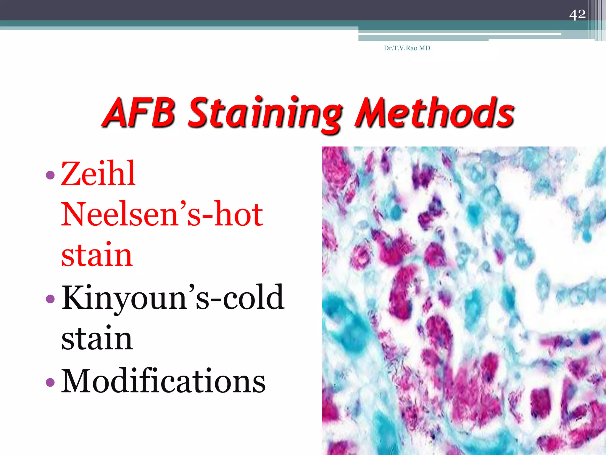AFB Staining Methods
•Zeihl
Neelsen’s-hot
stain
•Kinyoun’s-cold
stain
•Modifications
42
Dr.T.V.Rao MD
 