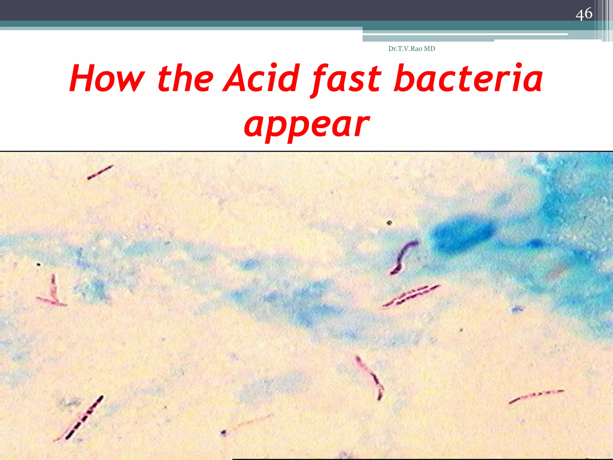 How the Acid fast bacteria
appear
46
Dr.T.V.Rao MD
 