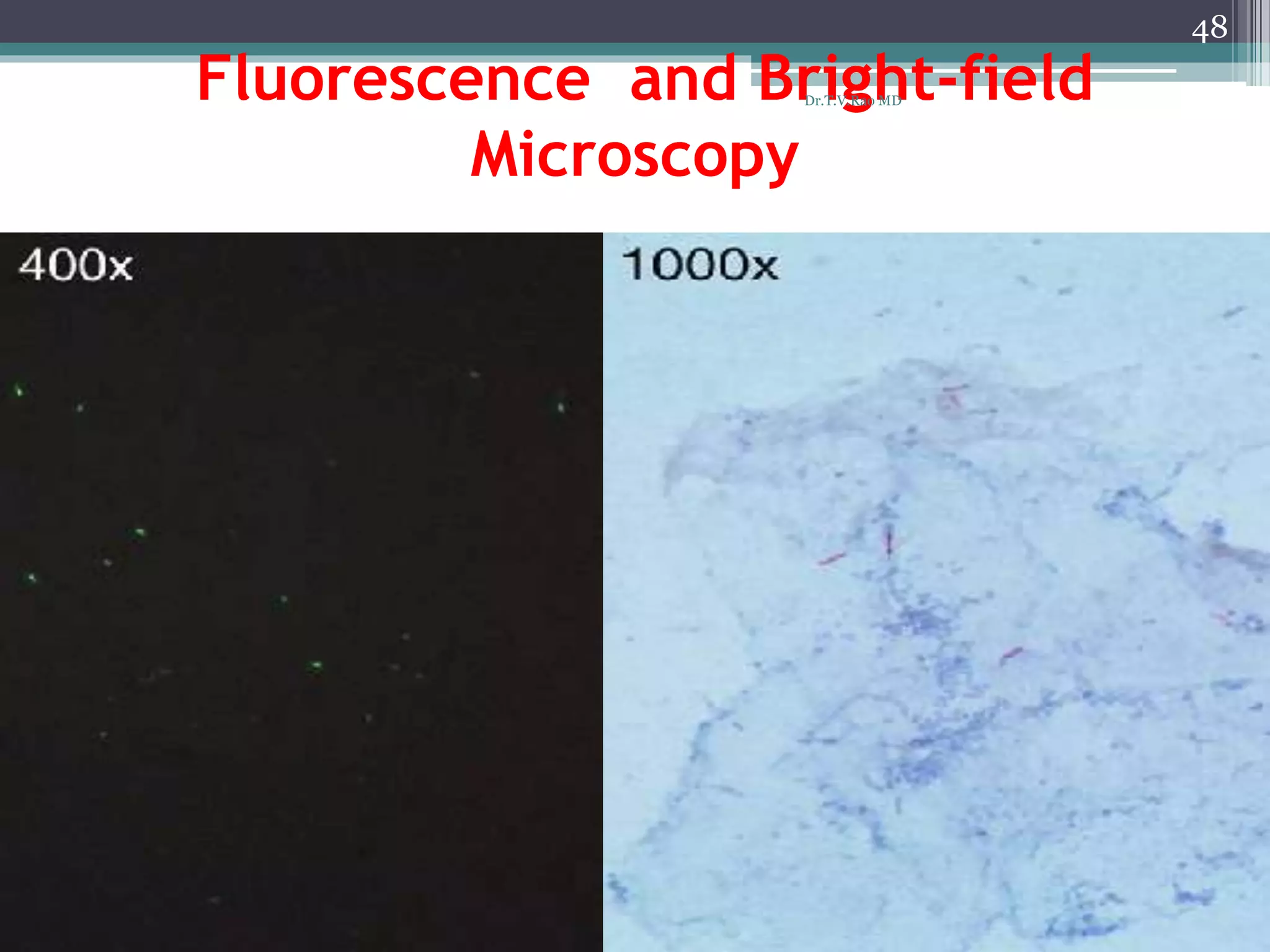 Fluorescence and Bright-field
Microscopy
48
Dr.T.V.Rao MD
 