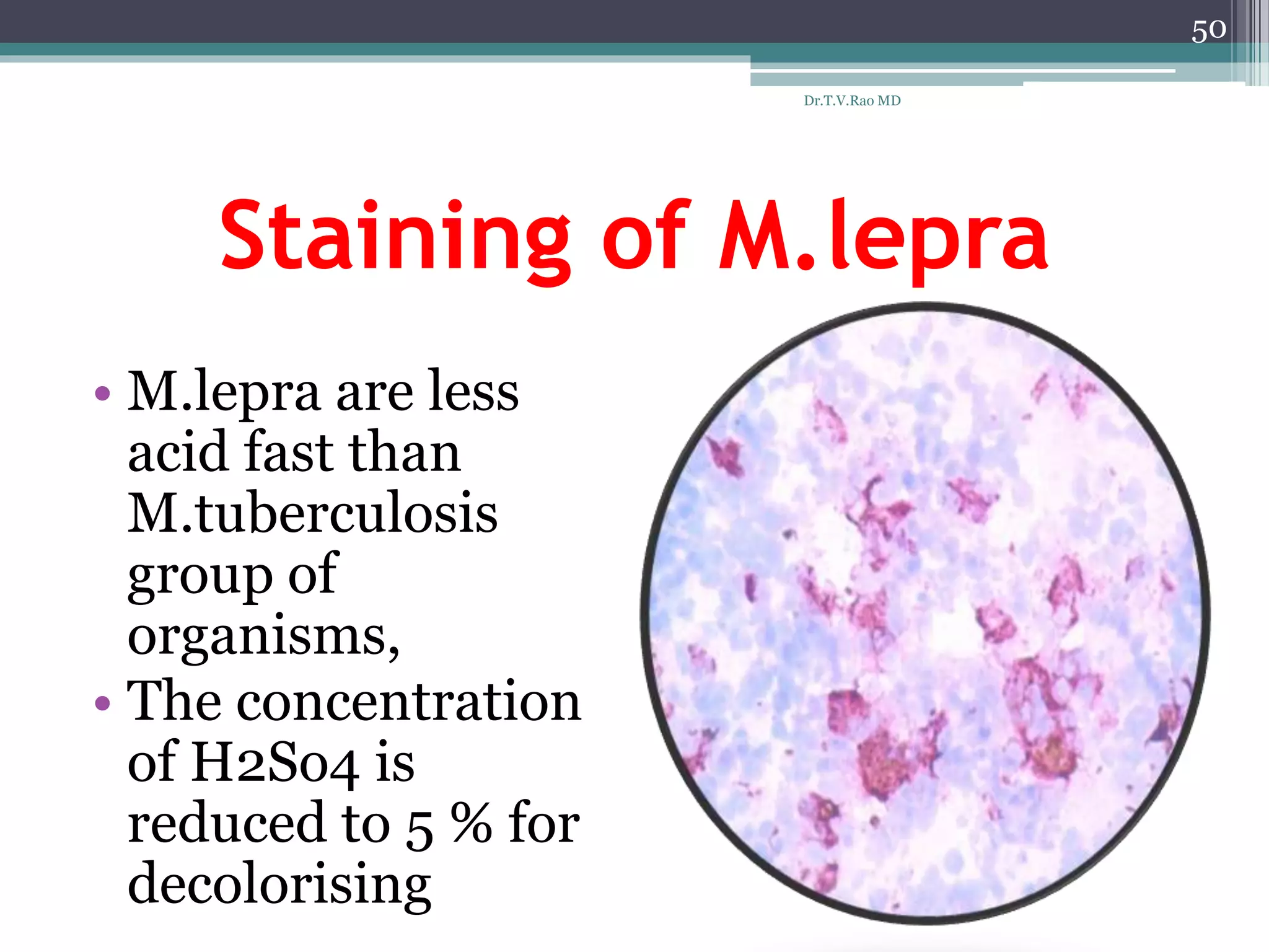 Staining of M.lepra
• M.lepra are less
acid fast than
M.tuberculosis
group of
organisms,
• The concentration
of H2So4 is
reduced to 5 % for
decolorising
50
Dr.T.V.Rao MD
 