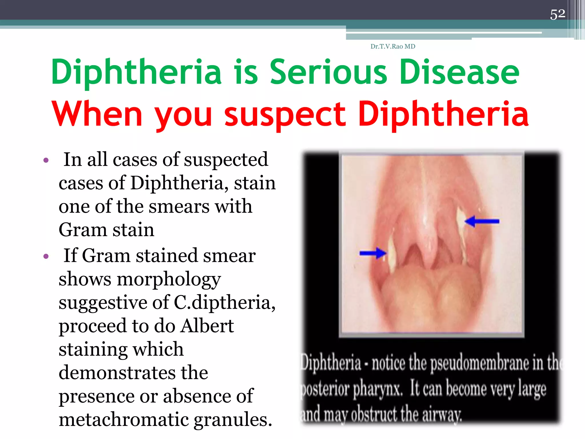 Diphtheria is Serious Disease
When you suspect Diphtheria
• In all cases of suspected
cases of Diphtheria, stain
one of the smears with
Gram stain
• If Gram stained smear
shows morphology
suggestive of C.diptheria,
proceed to do Albert
staining which
demonstrates the
presence or absence of
metachromatic granules.
52
Dr.T.V.Rao MD
 