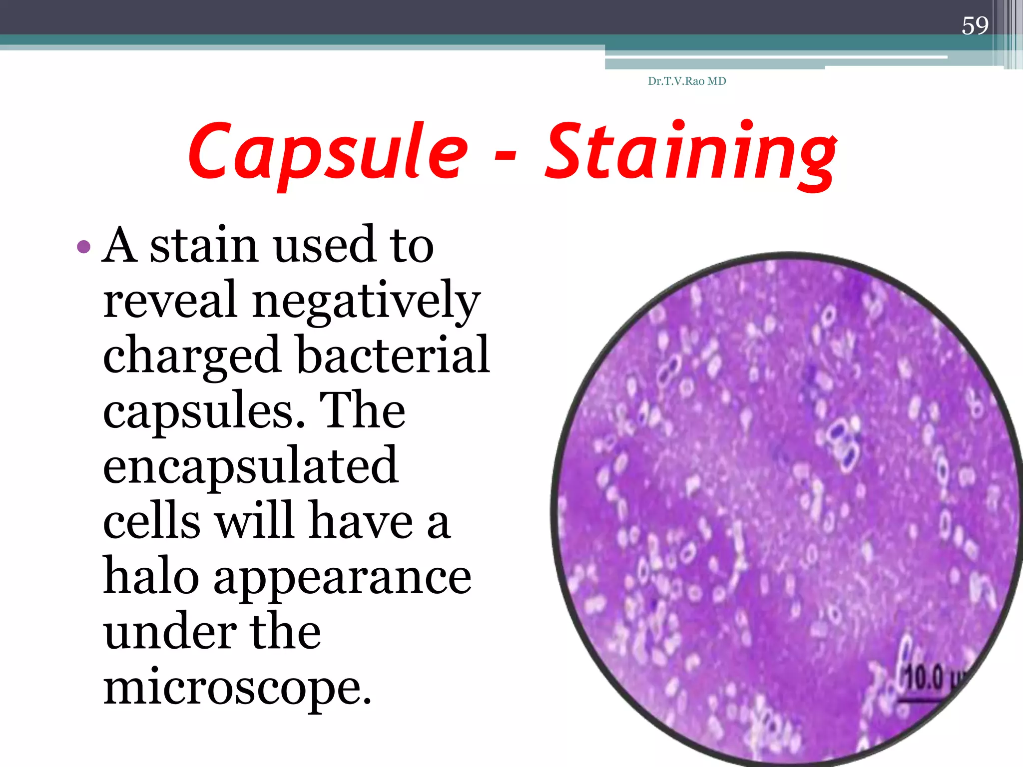 Capsule - Staining
• A stain used to
reveal negatively
charged bacterial
capsules. The
encapsulated
cells will have a
halo appearance
under the
microscope.
59
Dr.T.V.Rao MD
 