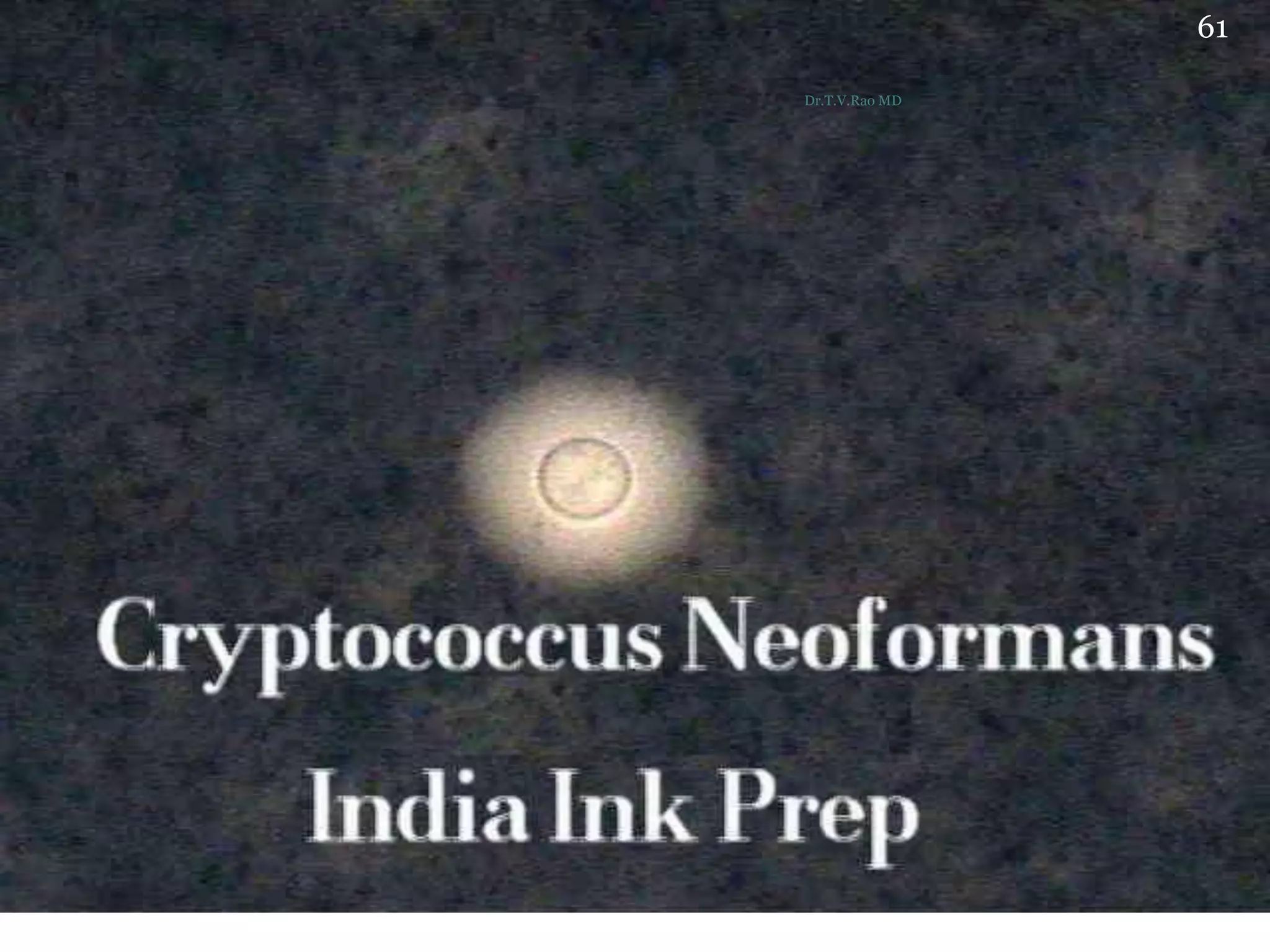 61
Dr.T.V.Rao MD
 