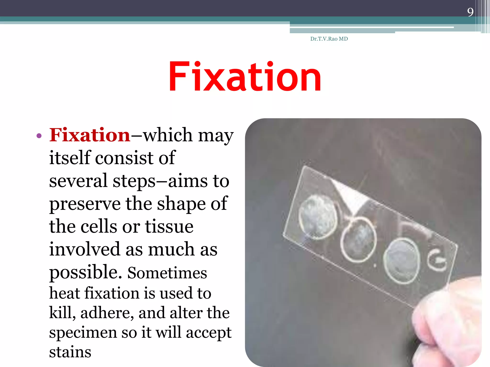 Fixation
• Fixation–which may
itself consist of
several steps–aims to
preserve the shape of
the cells or tissue
involved as much as
possible. Sometimes
heat fixation is used to
kill, adhere, and alter the
specimen so it will accept
stains
9
Dr.T.V.Rao MD
 