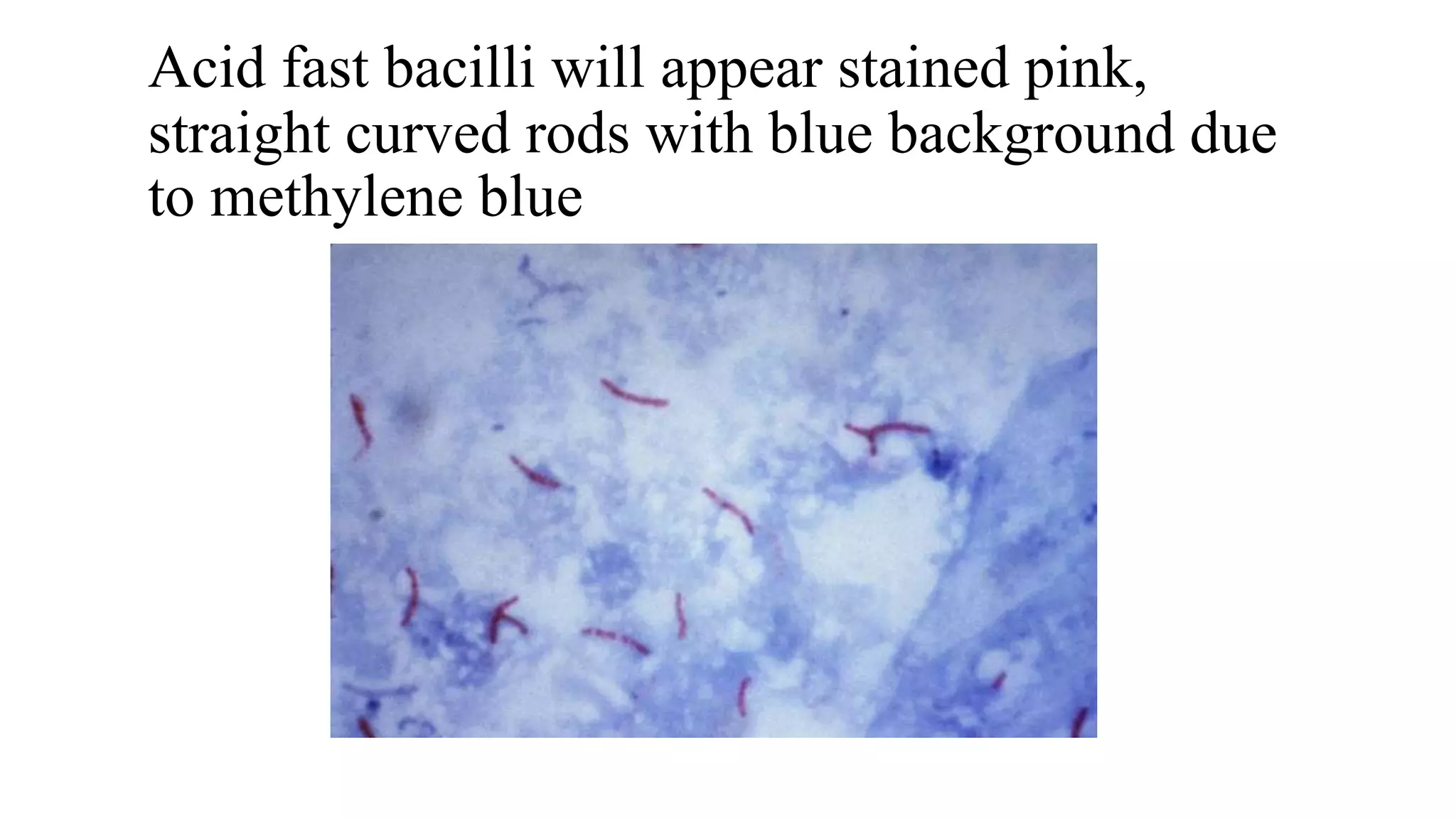 Acid fast bacilli will appear stained pink,
straight curved rods with blue background due
to methylene blue
 