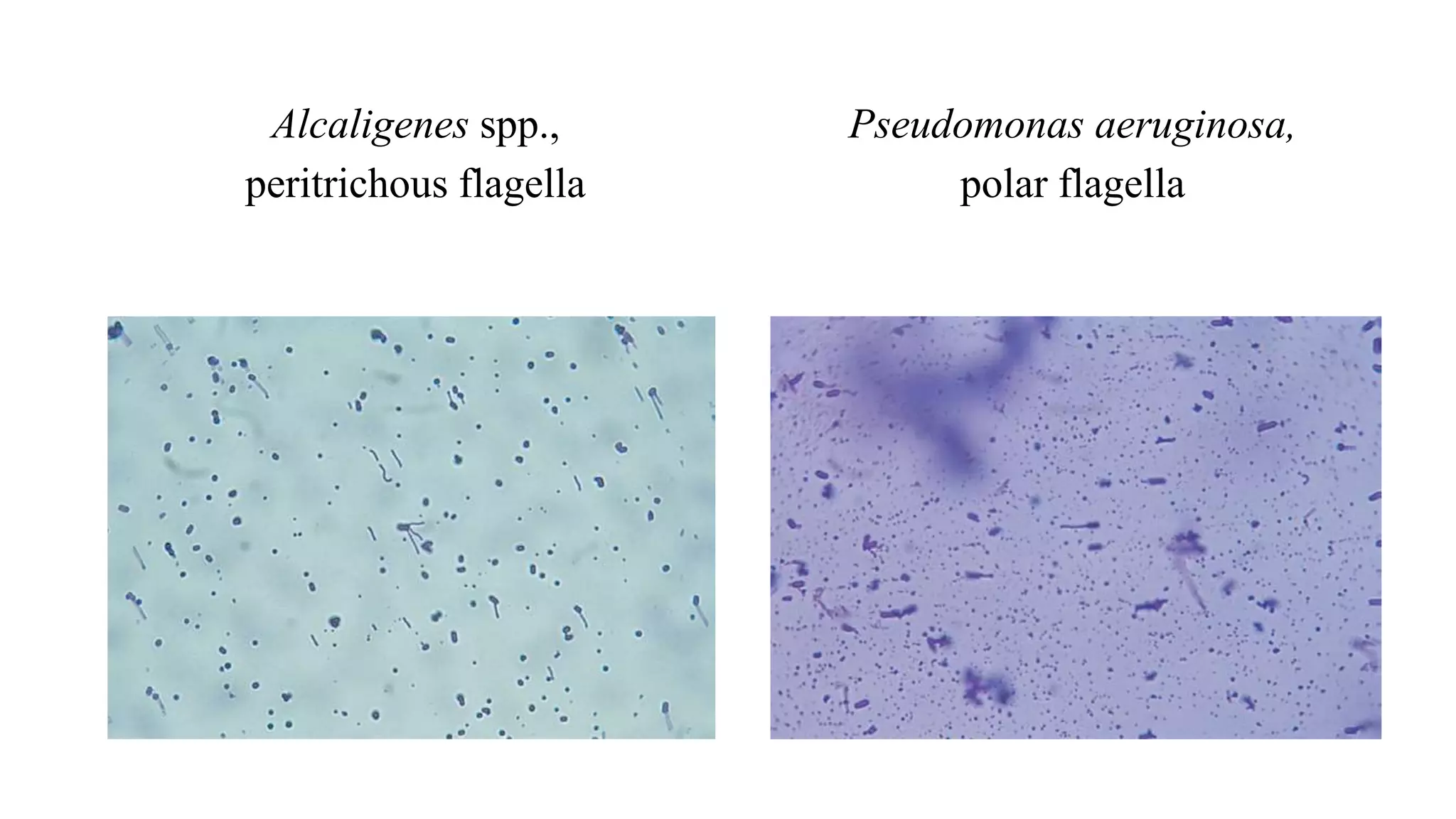 Alcaligenes spp.,
peritrichous flagella
Pseudomonas aeruginosa,
polar flagella
 