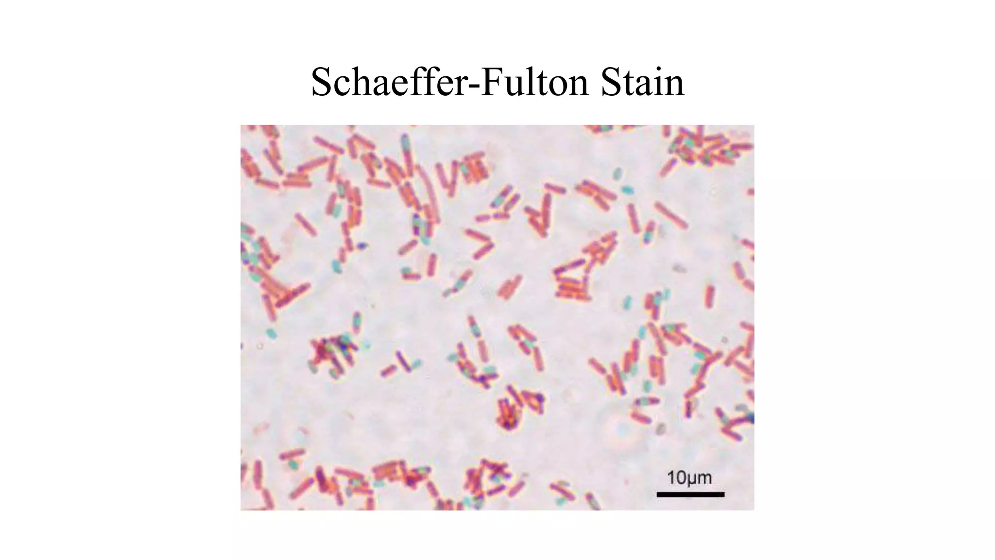 Schaeffer-Fulton Stain
 