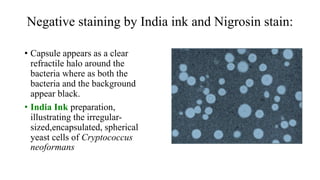 Staining of microorganisms | PPTX