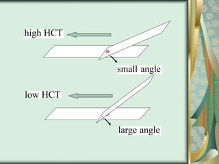 high HCT
low HCT
small angle
large angle
 