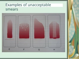 Examples of unacceptable
smears
 