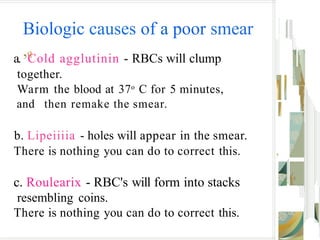 Biologic causes of a poor smear
,q
a. Cold agglutinin - RBCs will clump
together.
Warm the blood at 37o
C for 5 minutes,
and then remake the smear.
b. Lipeiiiia - holes will appear in the smear.
There is nothing you can do to correct this. ,
c. Roulearix - RBC's will form into stacks
resembling coins.
There is nothing you can do to correct this.
 