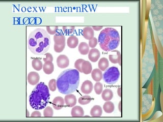 Noexw men•nRW
BLØØD
SMEAR
Neutrop
Eosl
Lymphosy ø
ț
 
