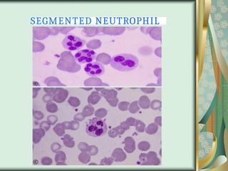SEGMENTED NEUTROPHIL
 