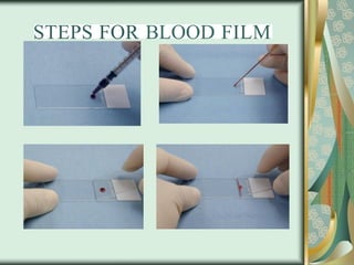 STEPS FOR BLOOD FILM
 