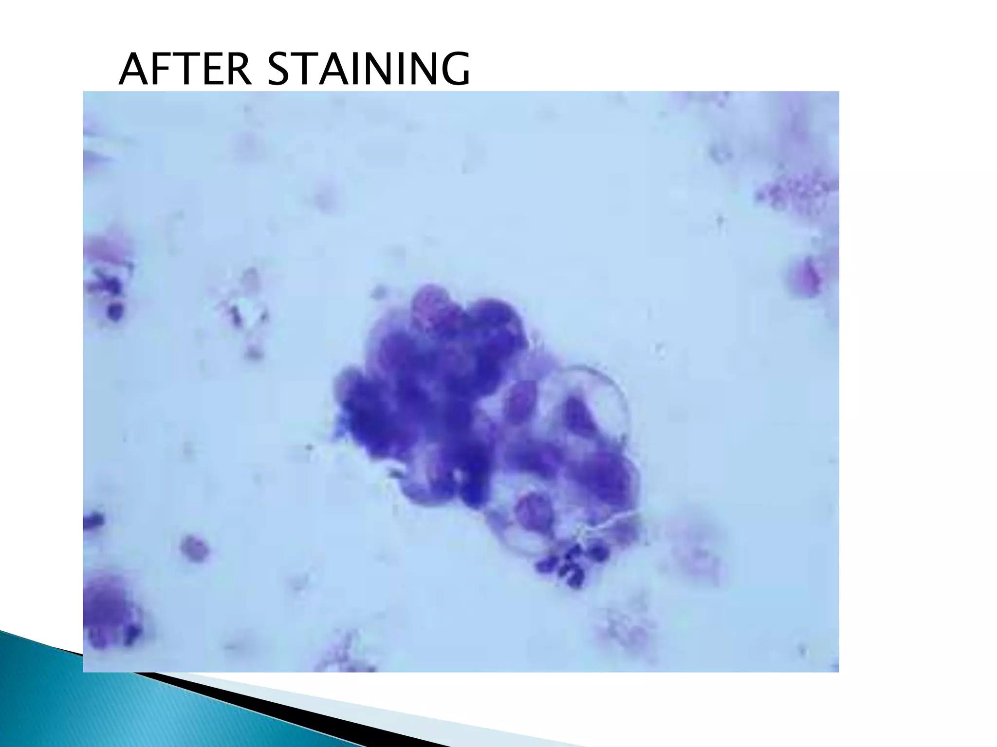 Staining ( rouine and special in cytology) rajiv kumar | PPTX