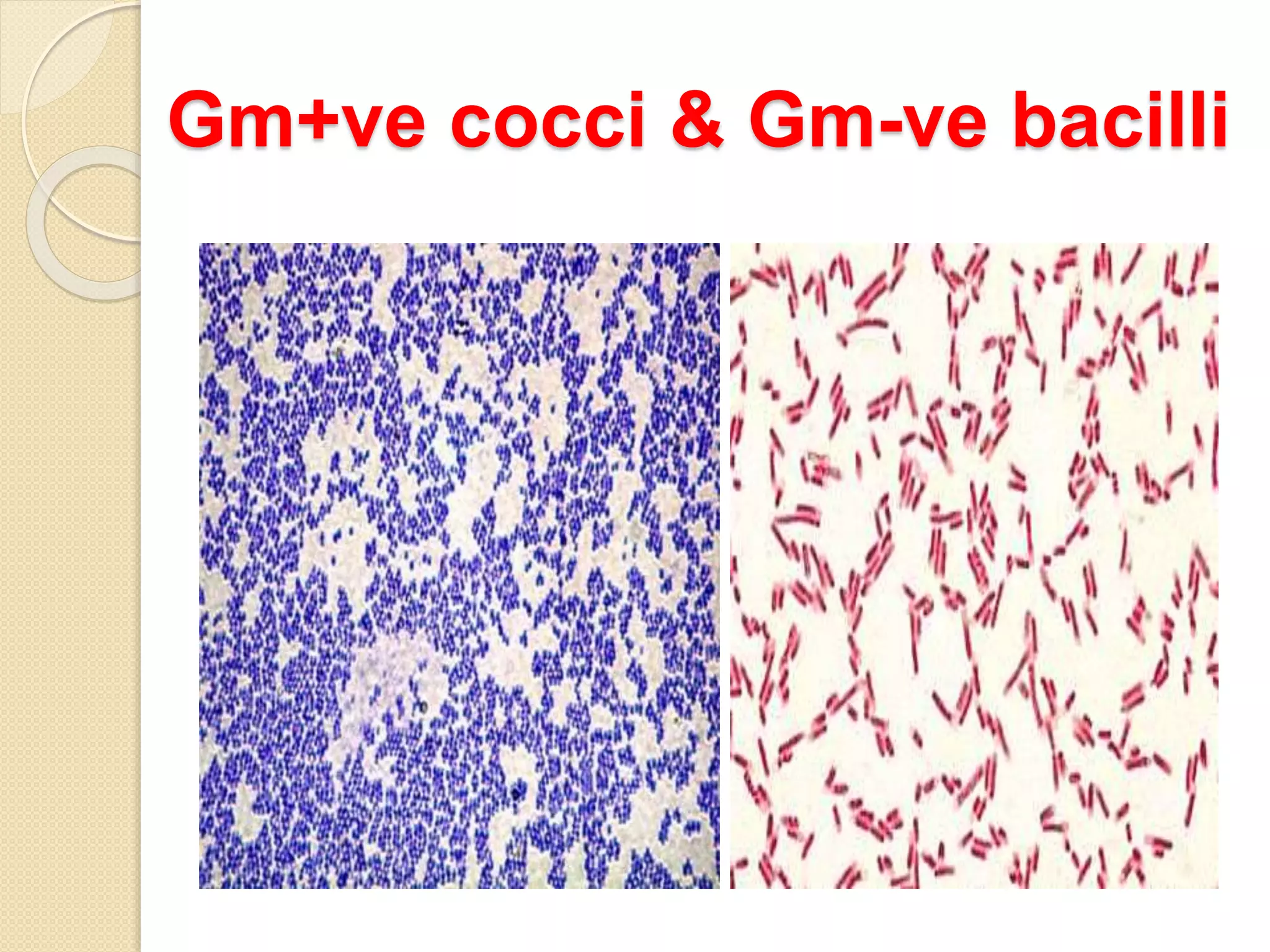 Gm+ve cocci & Gm-ve bacilli
 