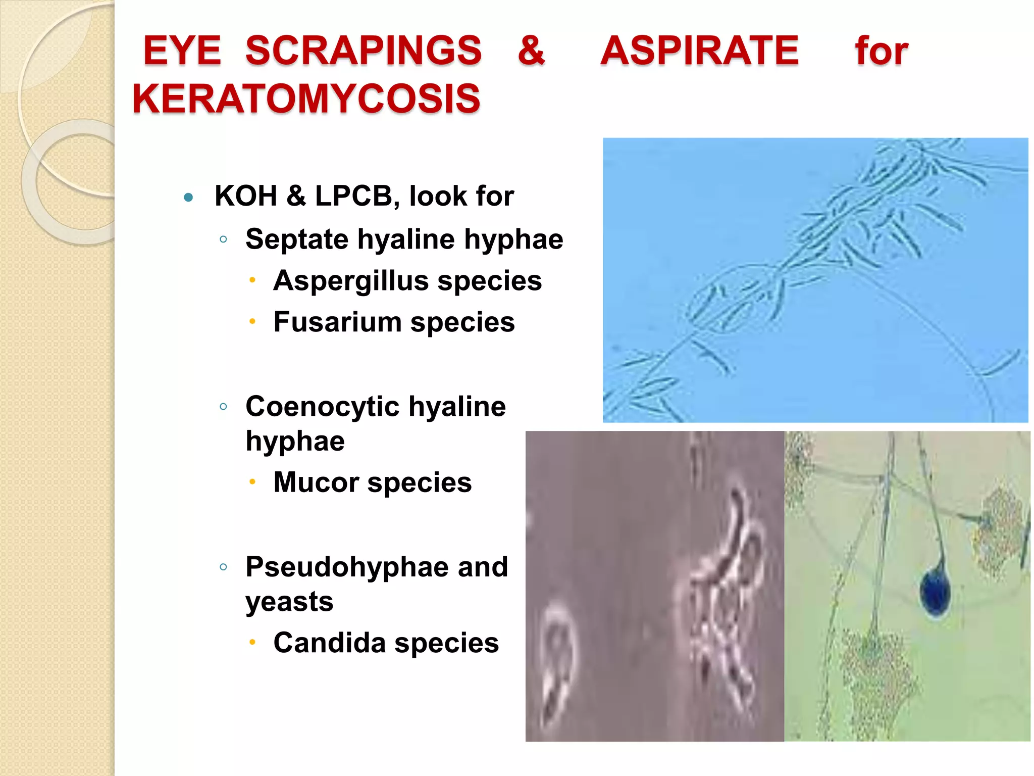 EYE SCRAPINGS & ASPIRATE for
KERATOMYCOSIS
 KOH & LPCB, look for
◦ Septate hyaline hyphae
 Aspergillus species
 Fusarium species
◦ Coenocytic hyaline
hyphae
 Mucor species
◦ Pseudohyphae and
yeasts
 Candida species
 