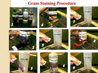 Gram Staining ProcedureGram Staining Procedure
Gram Staining Procedure
 