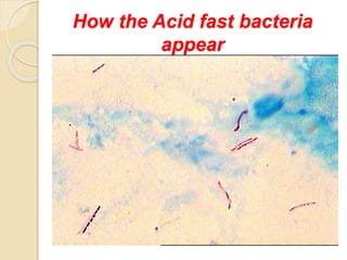 How the Acid fast bacteria
appear
 