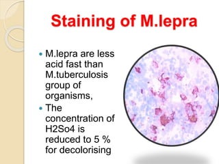 Staining of M.lepra
 M.lepra are less
acid fast than
M.tuberculosis
group of
organisms,
 The
concentration of
H2So4 is
reduced to 5 %
for decolorising
 